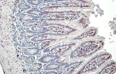 Immunohistochemistry-Paraffin: Histone H3 [Trimethyl Lys27] Antibody [NBP2-16840]